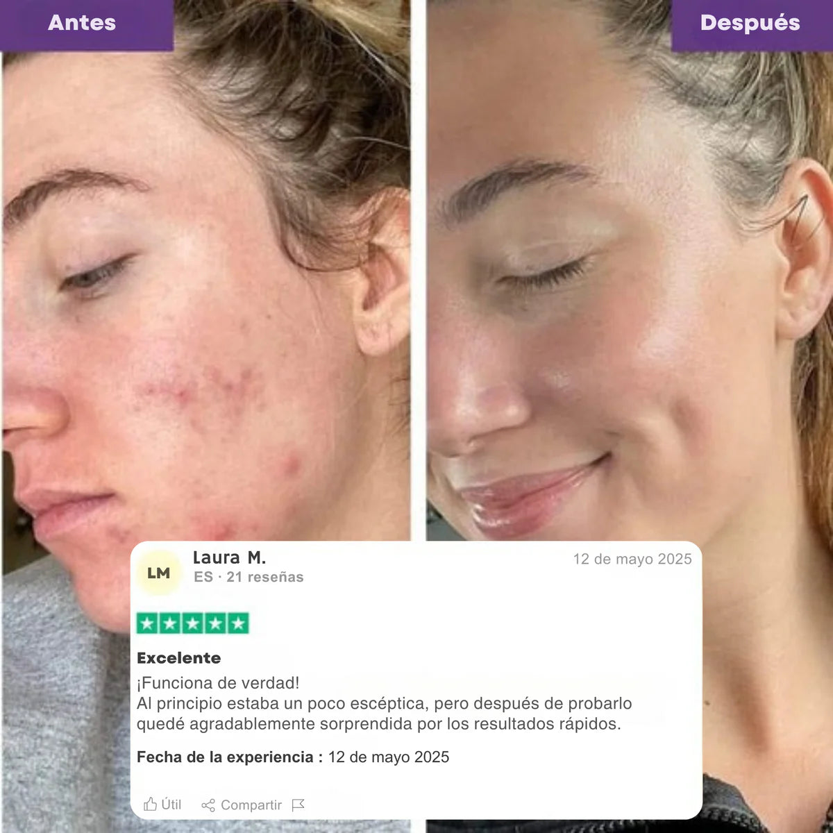 Coreana Turmeric Mascarilla