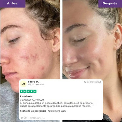 Coreana Turmeric Mascarilla